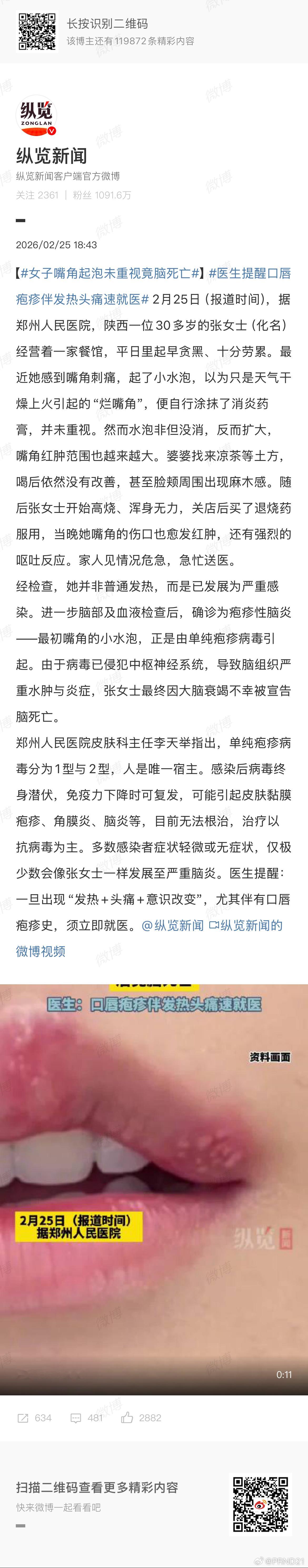 女子嘴角起泡未重视竟脑死亡 单纯疱疹病毒的感染非常多见，没感染过的反而是少数，大