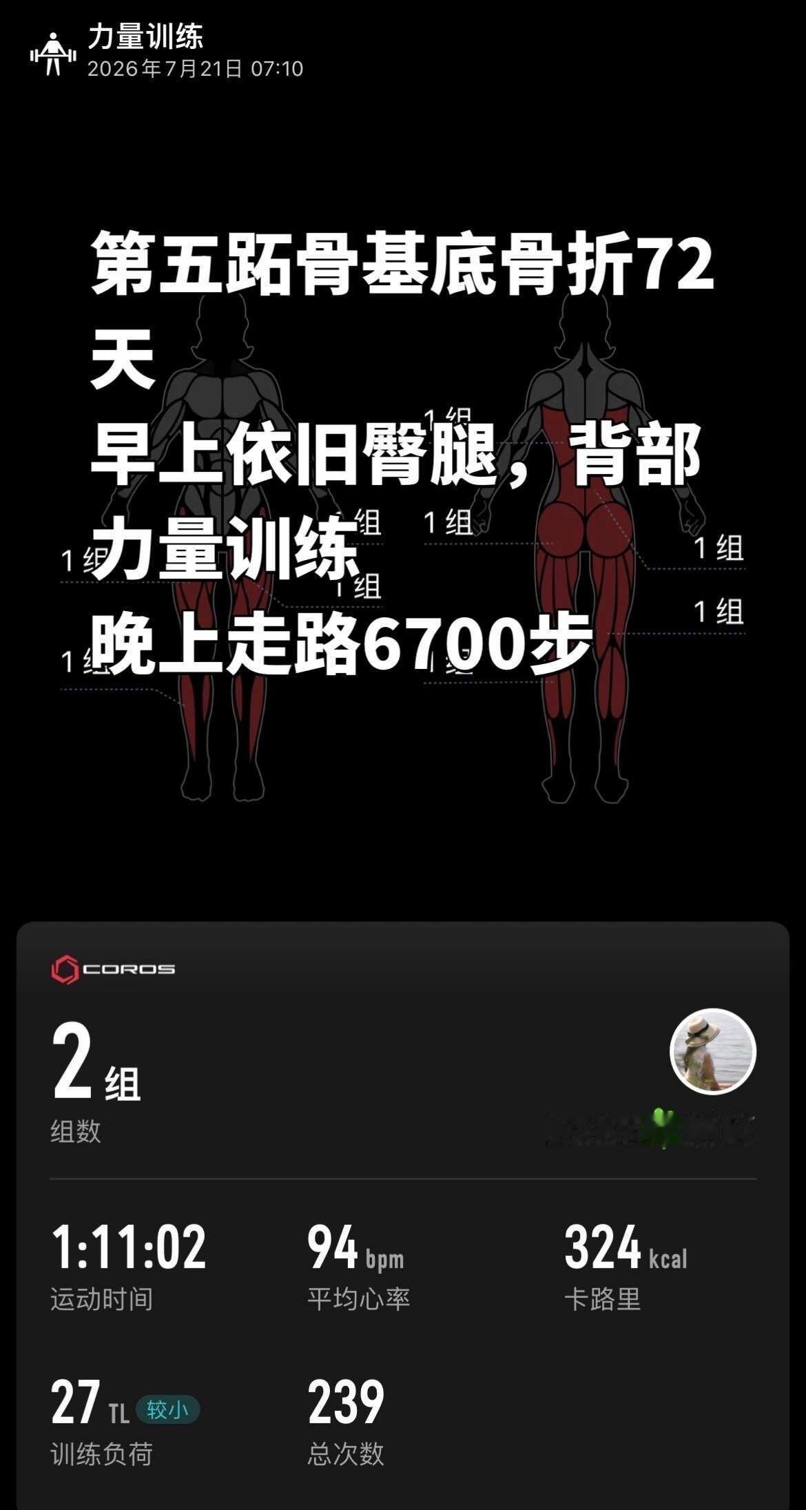 脚骨折第72天
努力恢复中 增强腿部力量 坚持锻炼身体 加油锻炼早日恢复
今日步