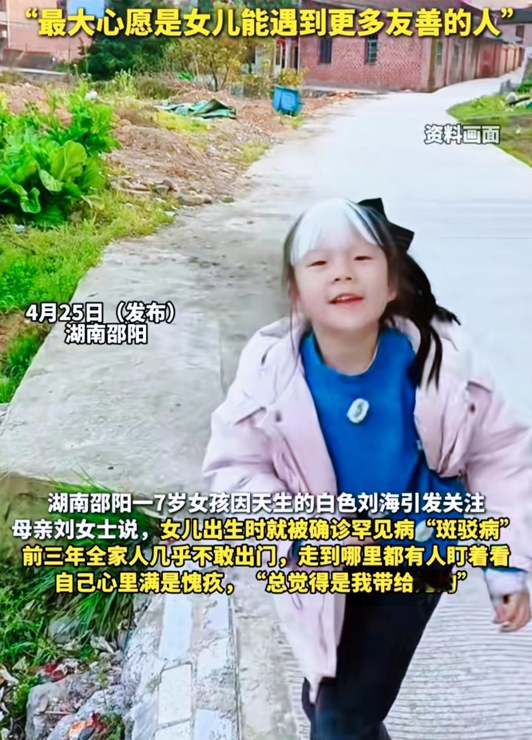7岁女孩天生“白色刘海”，心态超好

湖南邵阳有个7岁小姑娘，一生下来就带着一撮