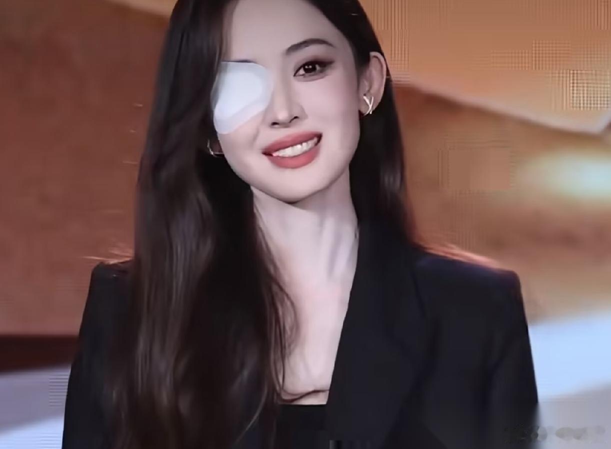 不是我想说娜扎， 而是实在有点看不下去， 出席活动，她眼睛还缠着纱布，我不想说她