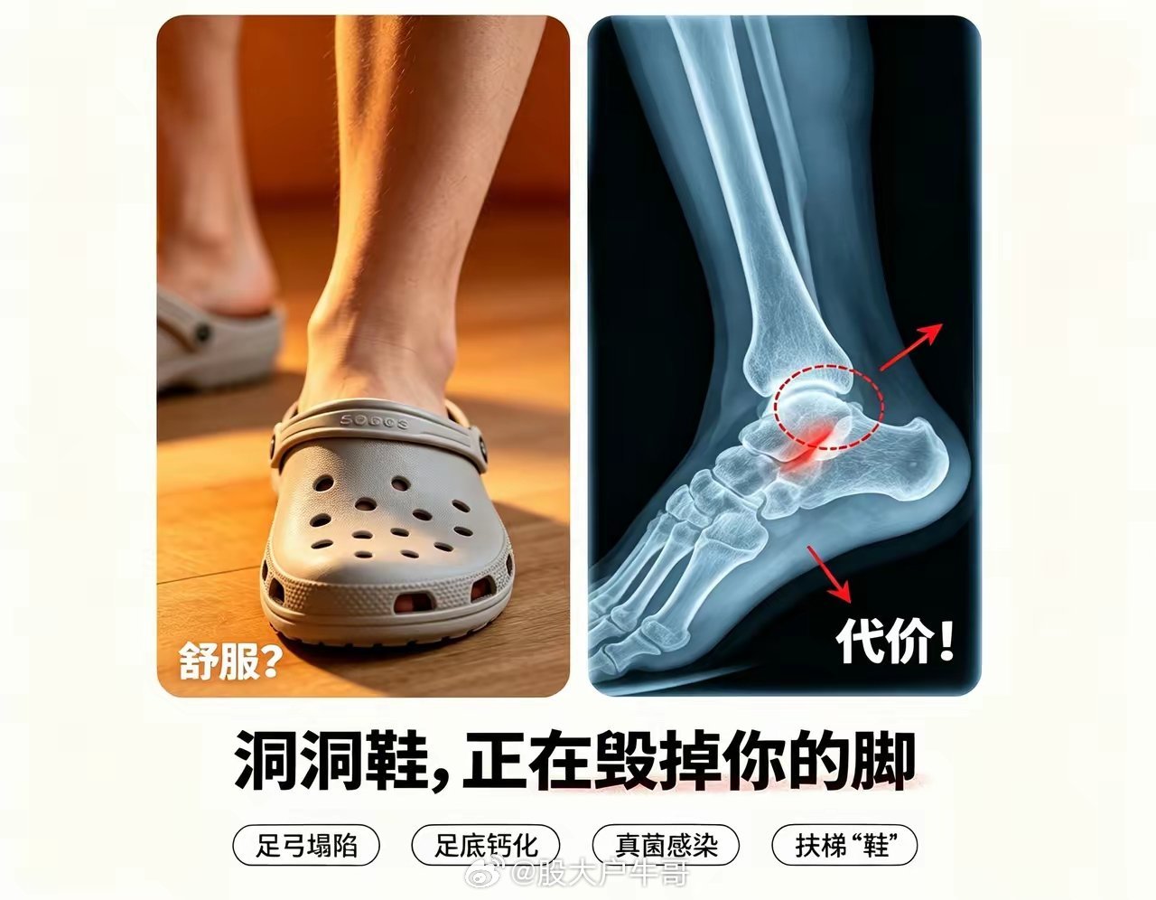 爱穿洞洞鞋的人，最近真的“天塌了”夏天人手一双的洞洞鞋，谁能不爱？轻便透气、一脚