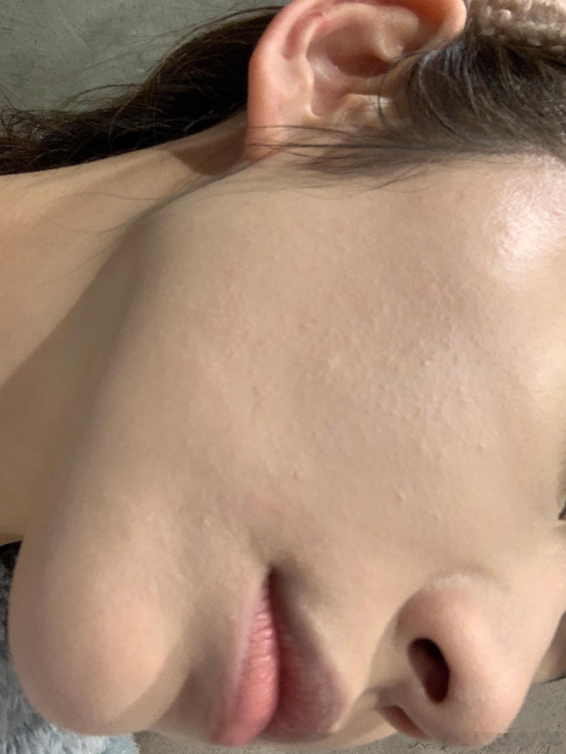 好痒好痒[苦涩] ​​​