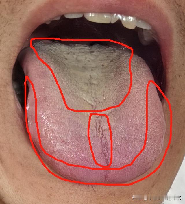 粉丝直接问我还有没有救，主要想调理一下男科[狗头][狗头][狗头]
总觉得房事无