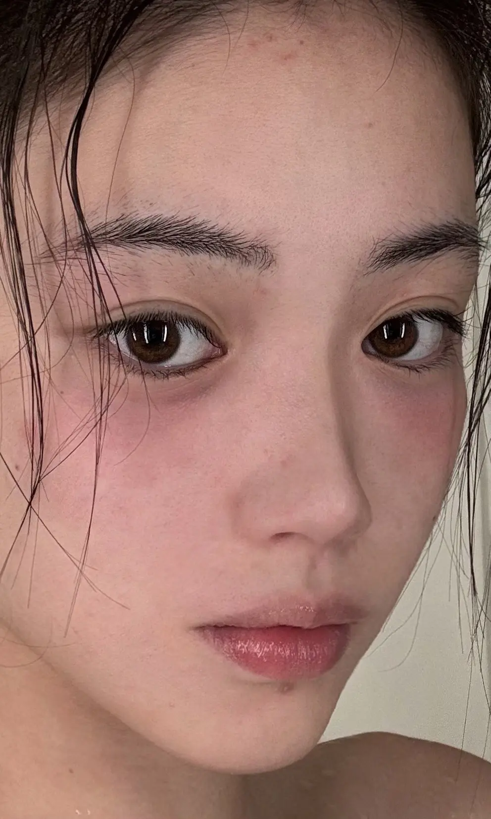 被虫咬了