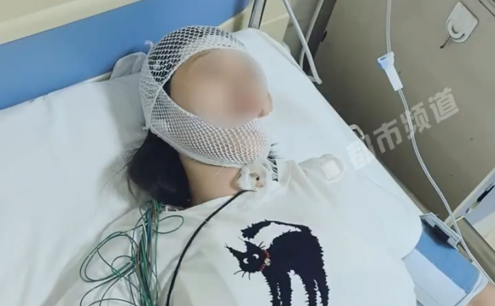 淋完雨竟进了ICU？医生紧急提醒：这三步不能省！