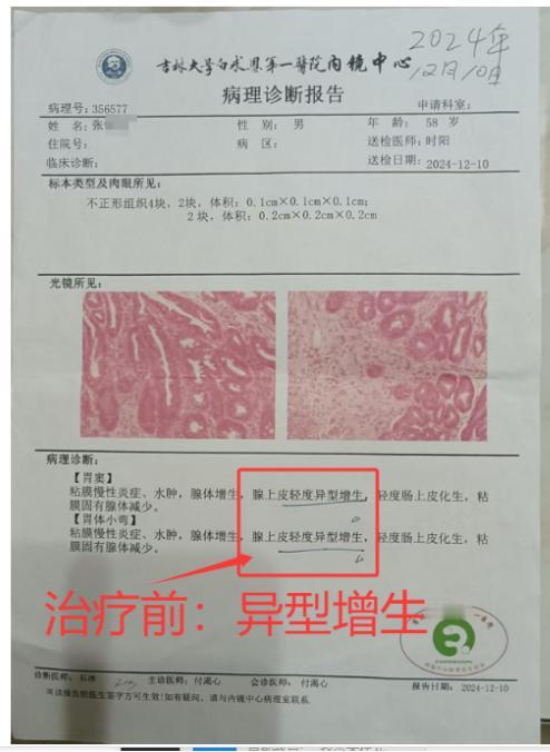 同一家医院的先后两次报告，癌前病变，异型增生消失！别再焦虑恐惧害怕了！