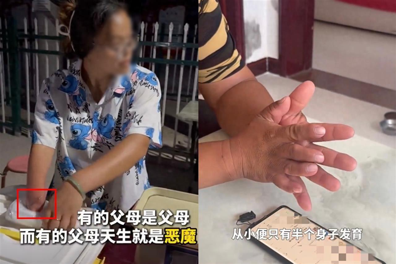 女子被迷信求子的父母迫害致残，砍手割耳？山西长治卖油条残疾夫妻引关注，残联：暂无