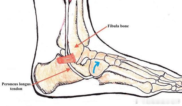 踝关节康复 脚踝疼痛？如果你脚背靠外侧按压会疼痛，内翻时疼痛加重，那你要小心——