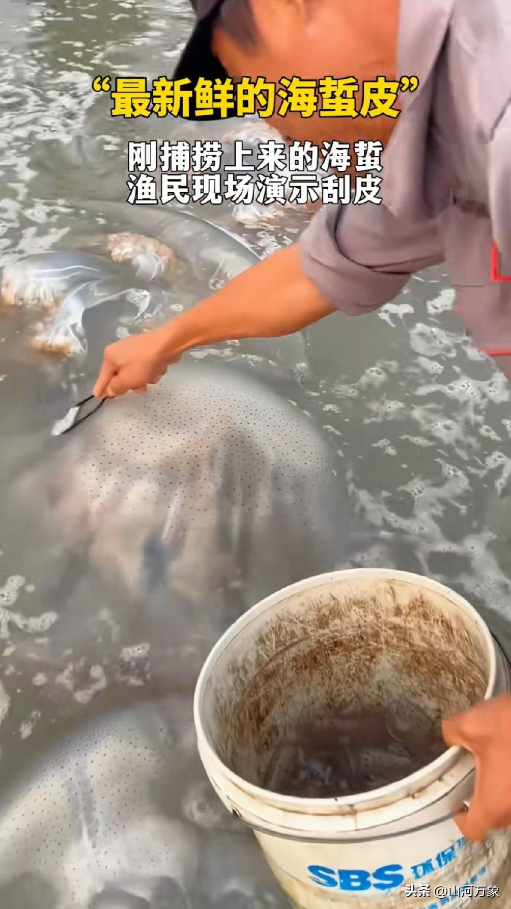 海蜇不疼吗？