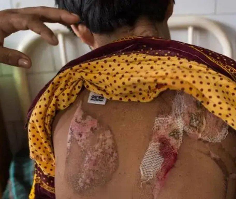 #9个孩子被骗缅甸遭电击开水烫#电击、开水烫、关水牢，最小的15岁，最大的大一，