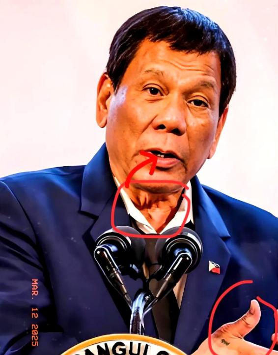 2026年1月26日，国际刑事法院正式裁定！

80岁的菲律宾前总统杜特尔特身体