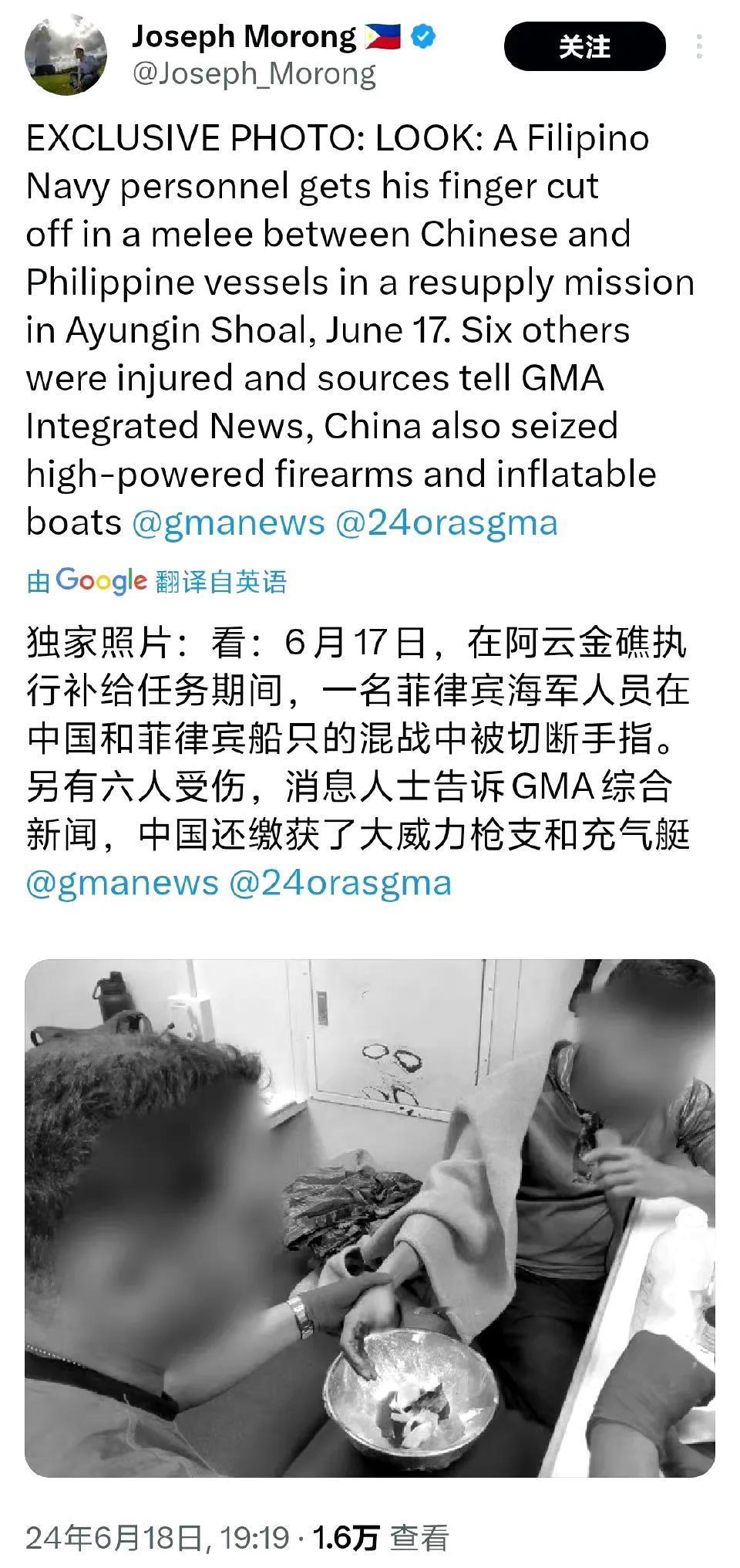 传说中的被我海警撞击时手指被切断的菲律宾海军特战队员，又菜又贱的怂货！

昨天（