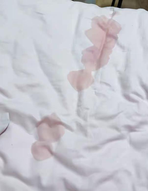 太吓人了！浙江杭州，女子半夜翻身，手碰到床单上一大滩冰凉液体，本以为是小猫撒的尿