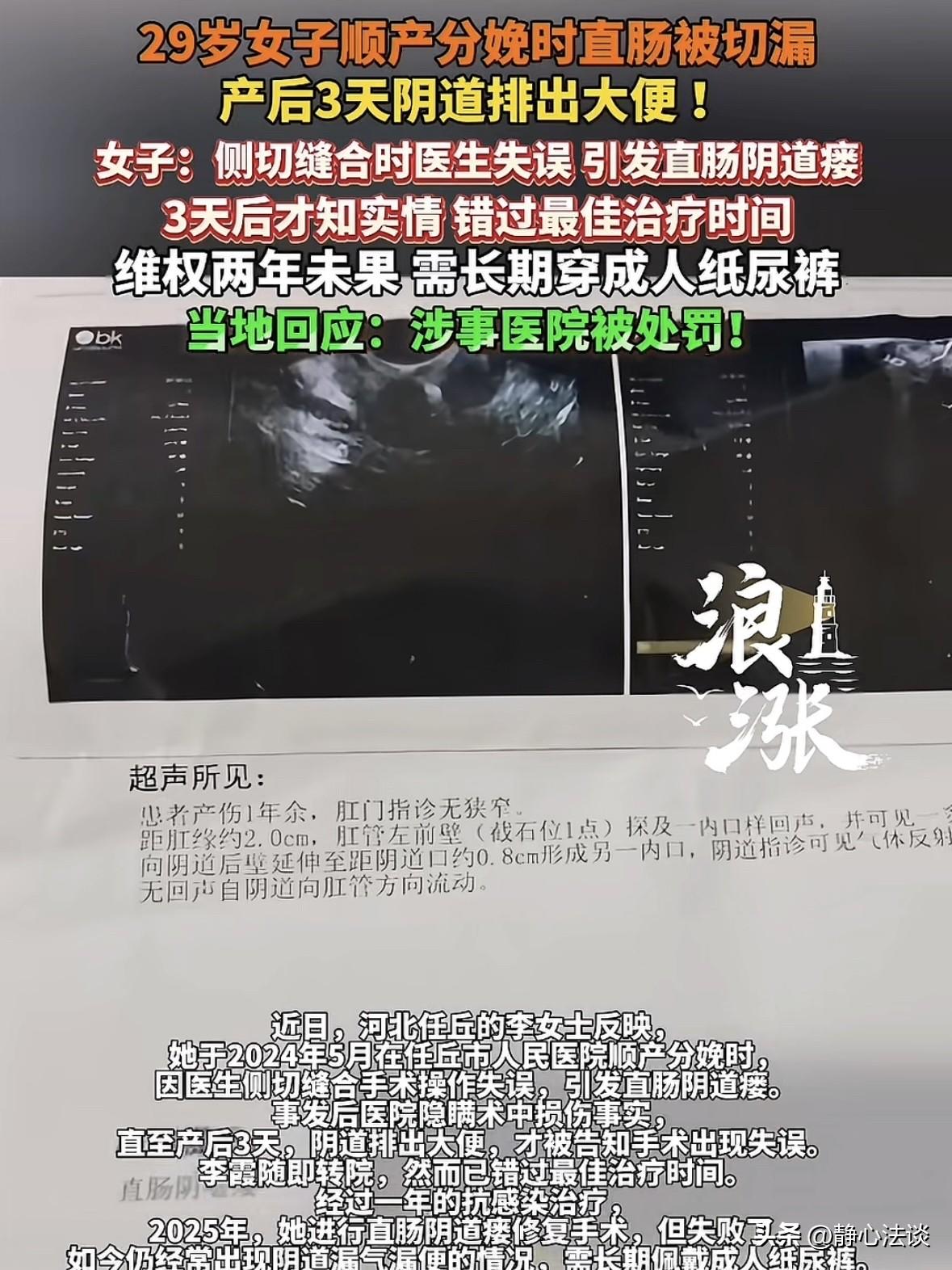 河北任丘，29岁女子顺产生娃，3天后从阴道里排出大便，女子懵了，赶紧去医院查看，