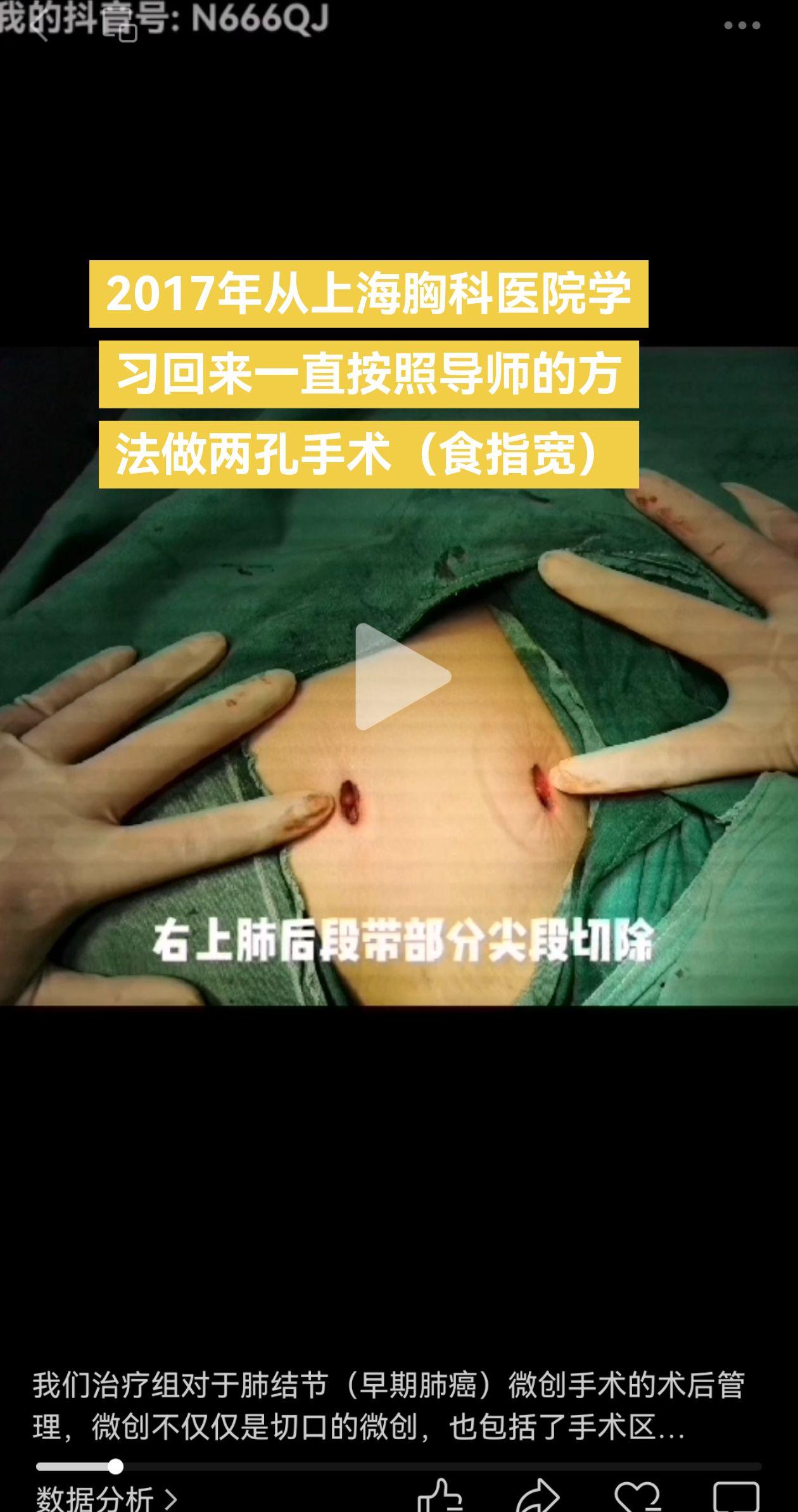 单孔or两孔？单孔还是两孔，适合自己的方法就是最好的方法……