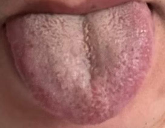 身体状态不如从前？不妨试试中医调养思路






年纪轻轻就出现了功能问题，海