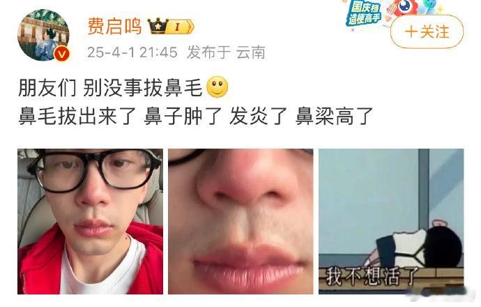 费启鸣现在怎么长这样啊 想起来知否里大娘子的经典名言：低声些 难道光彩吗哈哈哈哈