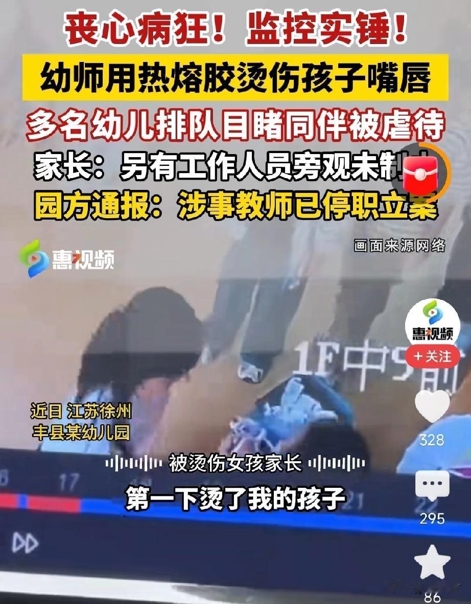 我问我的同事，按说一个幼师必须得有很有爱心才行，这个幼师怎么能做出这么残忍的事？