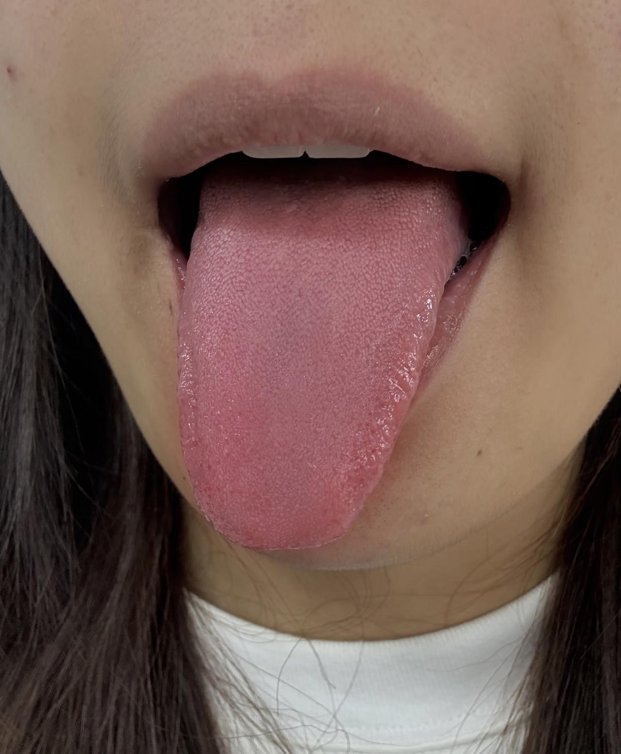 湿气也分“冷热”？专家警告：这种湿气越喝凉茶越严重！
90%的人都搞错了
🌿 