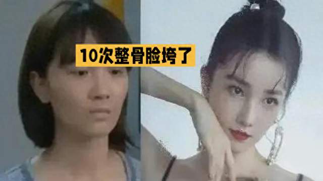 陈小纭彻底翻车！10次整骨换来的美貌，终究付出了惨痛代价