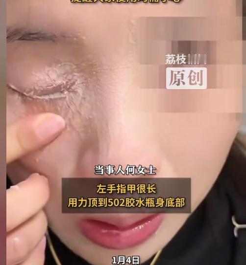 “悲剧还是发生了！”近日，贵州贵阳，一女子在家粘贴穿戴甲时，因自带的指甲胶不牢固