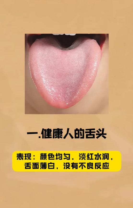 肝郁、化火、血瘀六种舌象汇总，疏肝理气改善海绵体状态