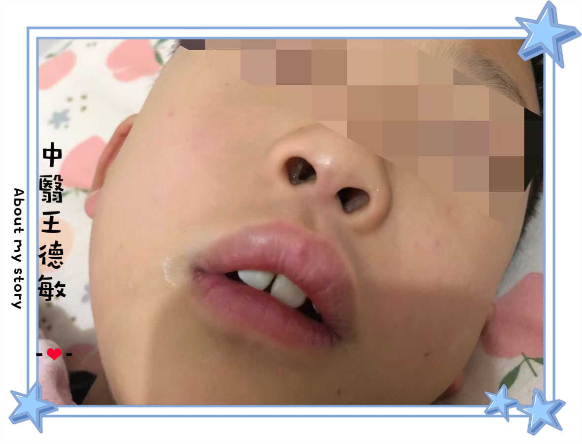 中翳康尧健康养生 [赞][赞]康尧让天下没有难治的鼻炎[赞][赞][心]一提到孩
