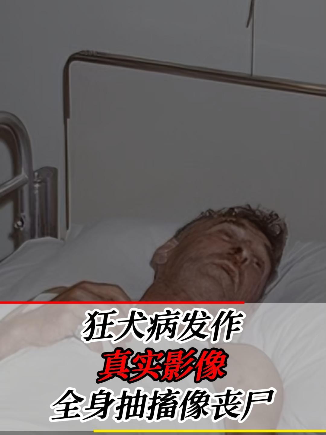 强烈呼吁：
        世界医学应尽快攻克“狂犬病”毒药物！
       