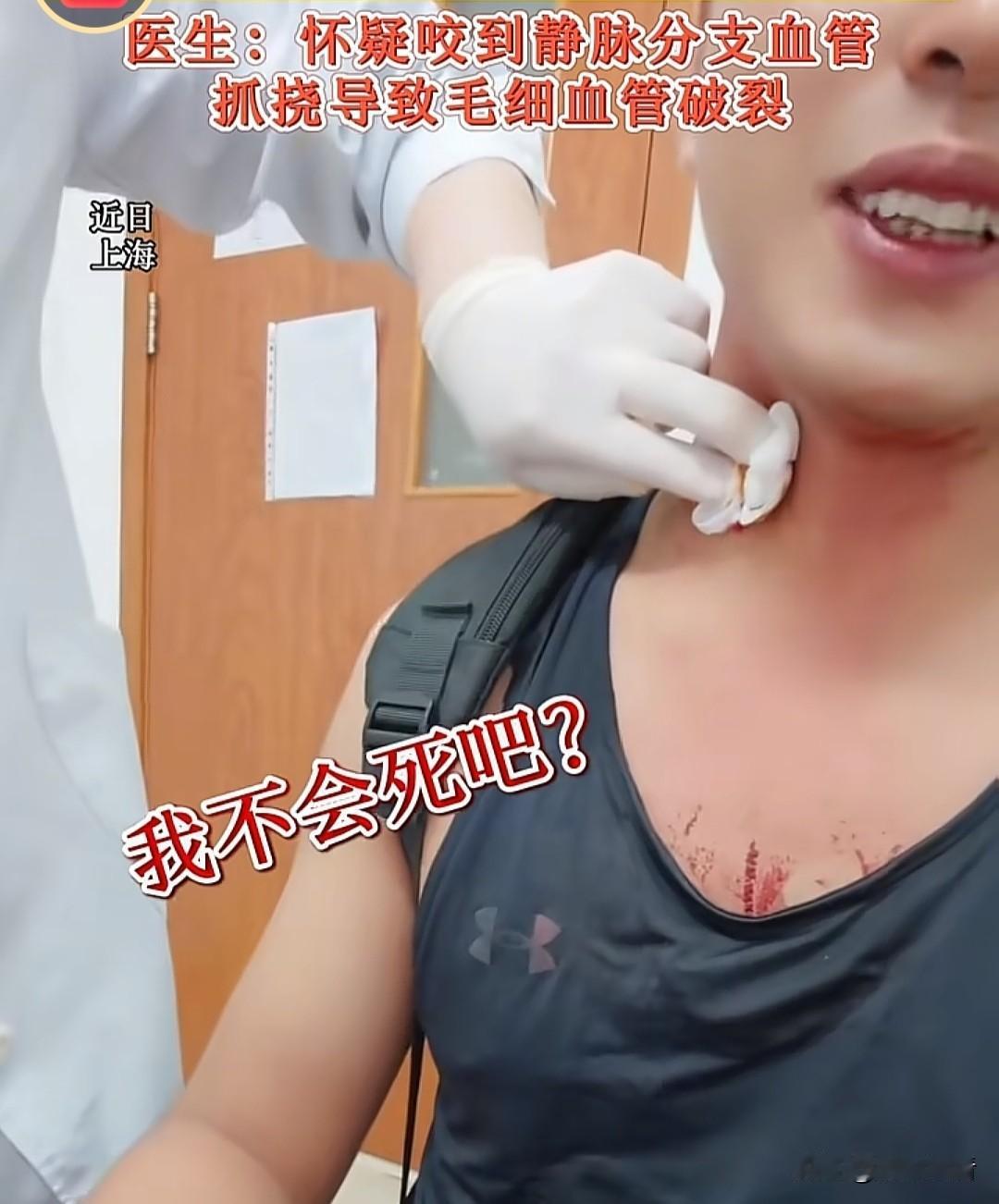属实刷新认知，万万没想到小小的蚊子差点上演“单杀人类”！近日，上海有位大哥被蚊子