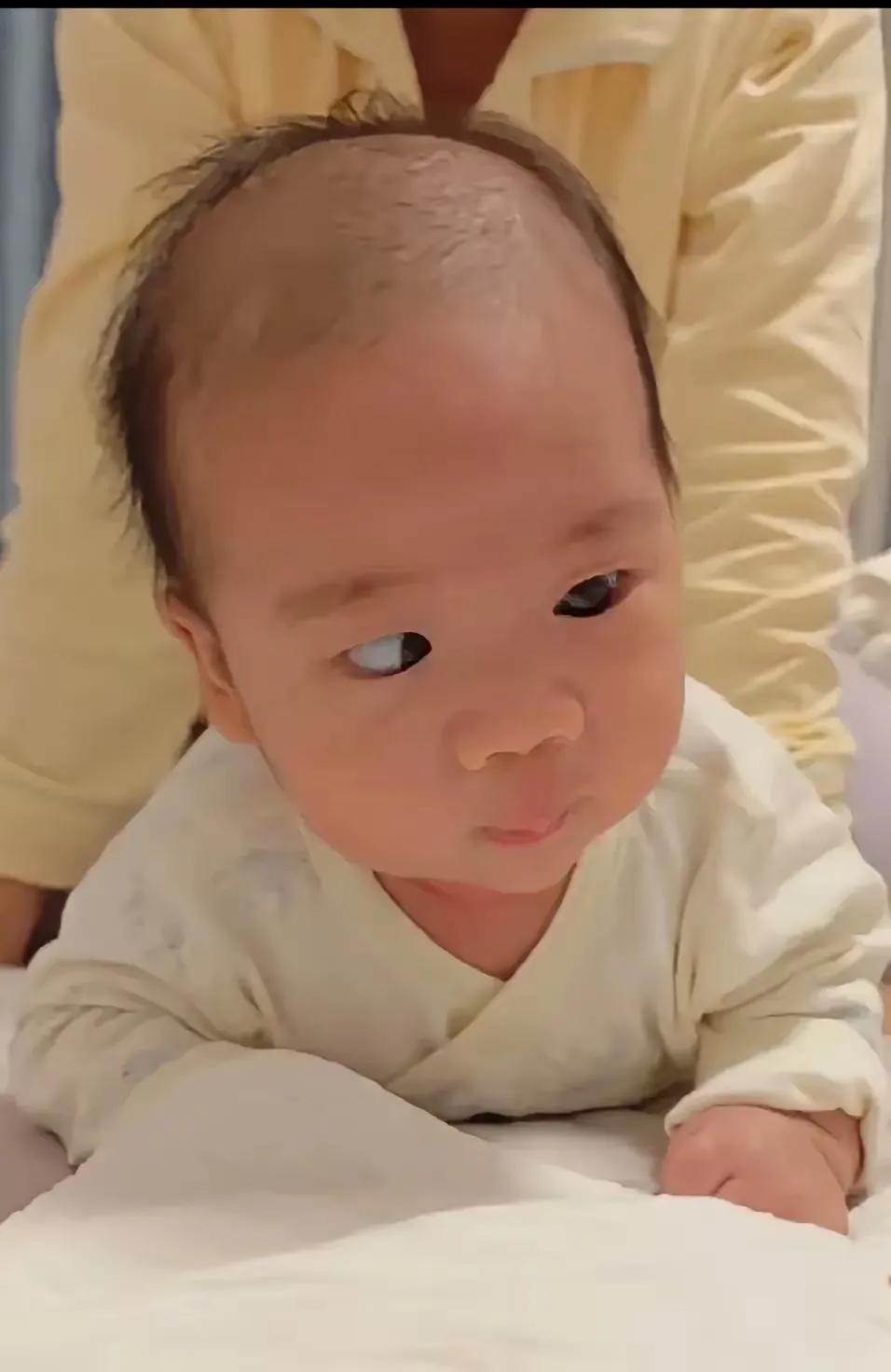 小孩子眼睛怎么会突然这样？
一位妈妈被自己的孩子吓了一跳，只见孩子一只眼睛明显内