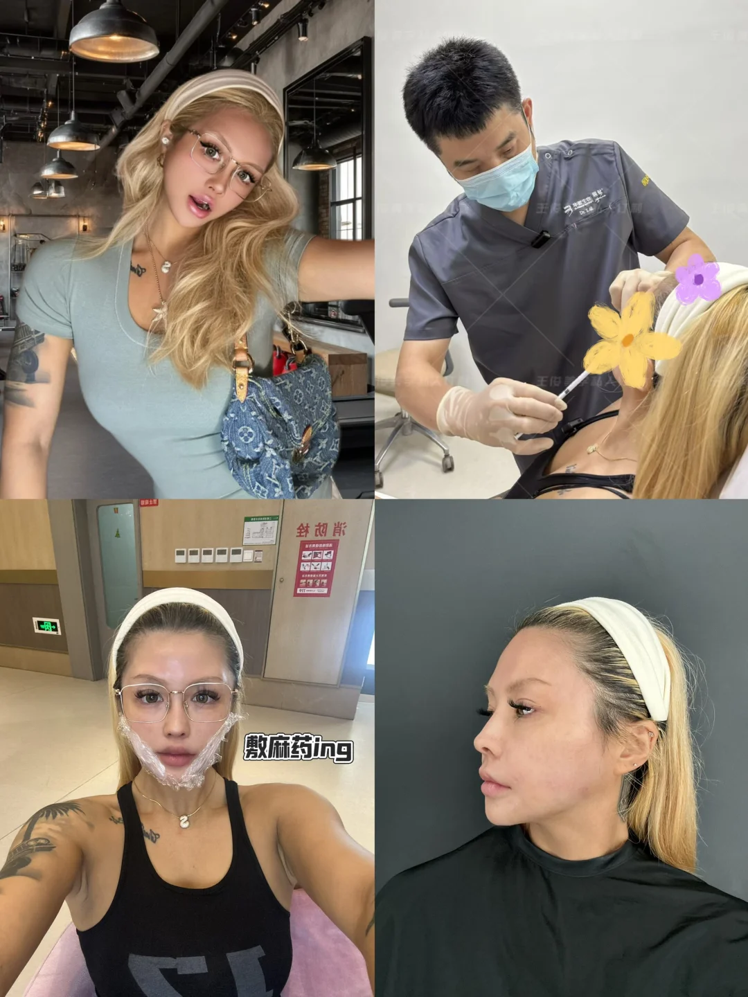 女生为了变美能有多拼🤎