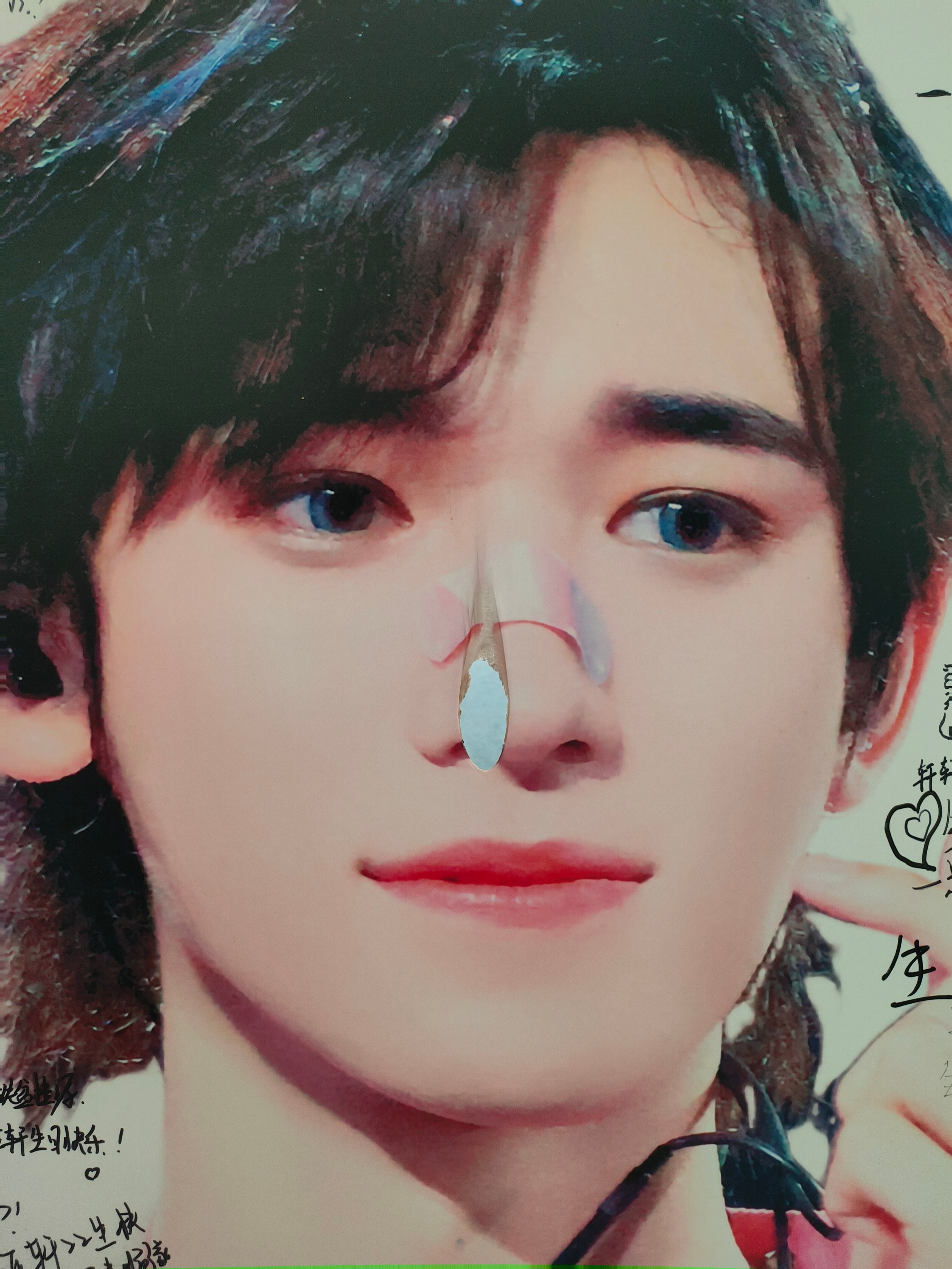 哪个没素质的男的给我老公脸上用烟头烫了一个洞