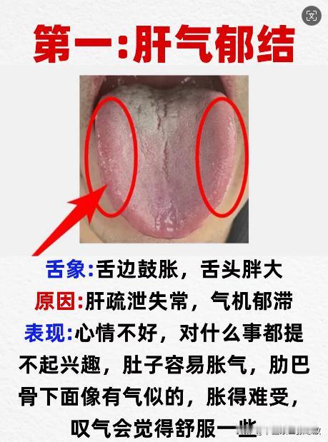 肝郁气滞，肝郁化热，肝阳上亢，肝郁血虚，肝郁血瘀
肝郁的5大症型，中医手把手教你