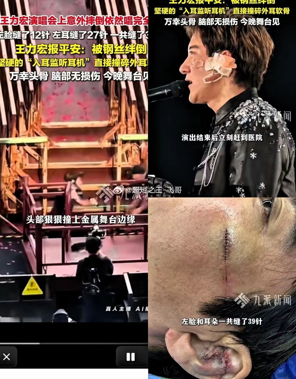 谁能想到一场万人演唱会，舞台上暗藏致命隐患！王力宏当场摔倒血流满面，里外缝满39