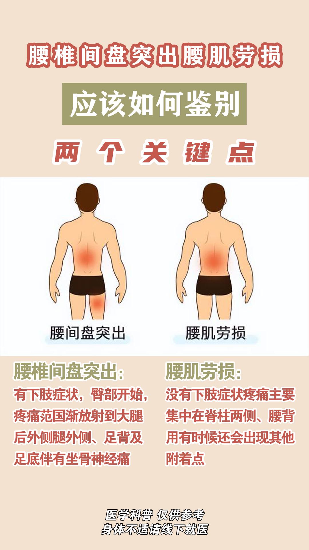 腰椎间盘突出 腰肌劳损