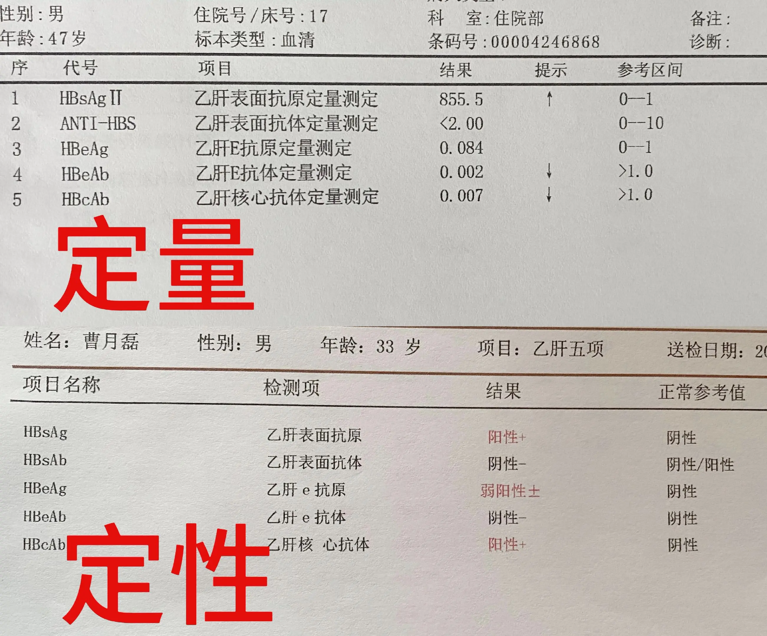 乙肝五项，做定性还是定量。很多朋友都不知道乙肝五项检查，做一个定性还是...