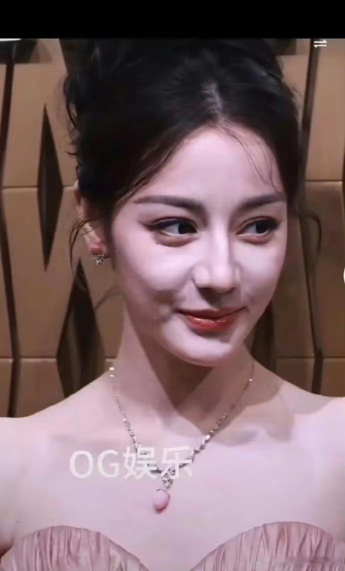 迪丽热巴皮肤状态这么虐的吗？ ​​​