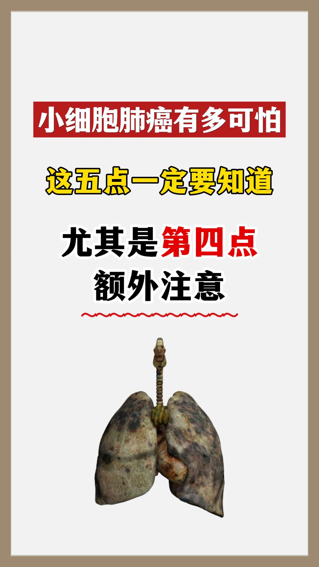小细胞肺癌有多可怕，这五点一定要知道。