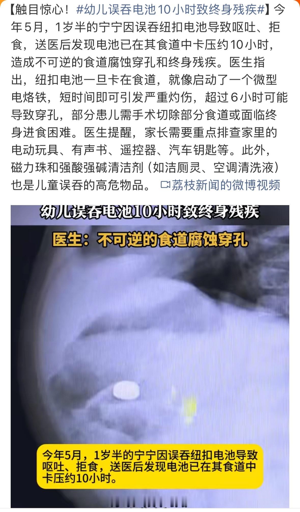 太可怕了，家里有孩子的一定要多注意带电池的玩具、遥控器，千万千万注意，才一岁半的