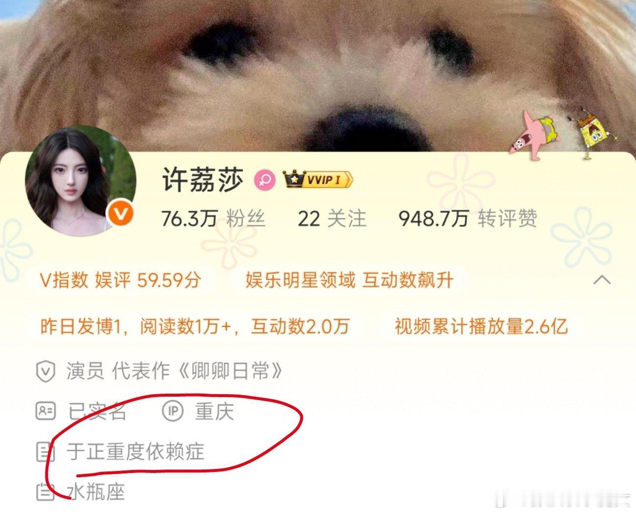 许荔莎 我以后缠着于正了许荔莎是不是准备24小时待机示爱于正啊？不愧是于正重度依