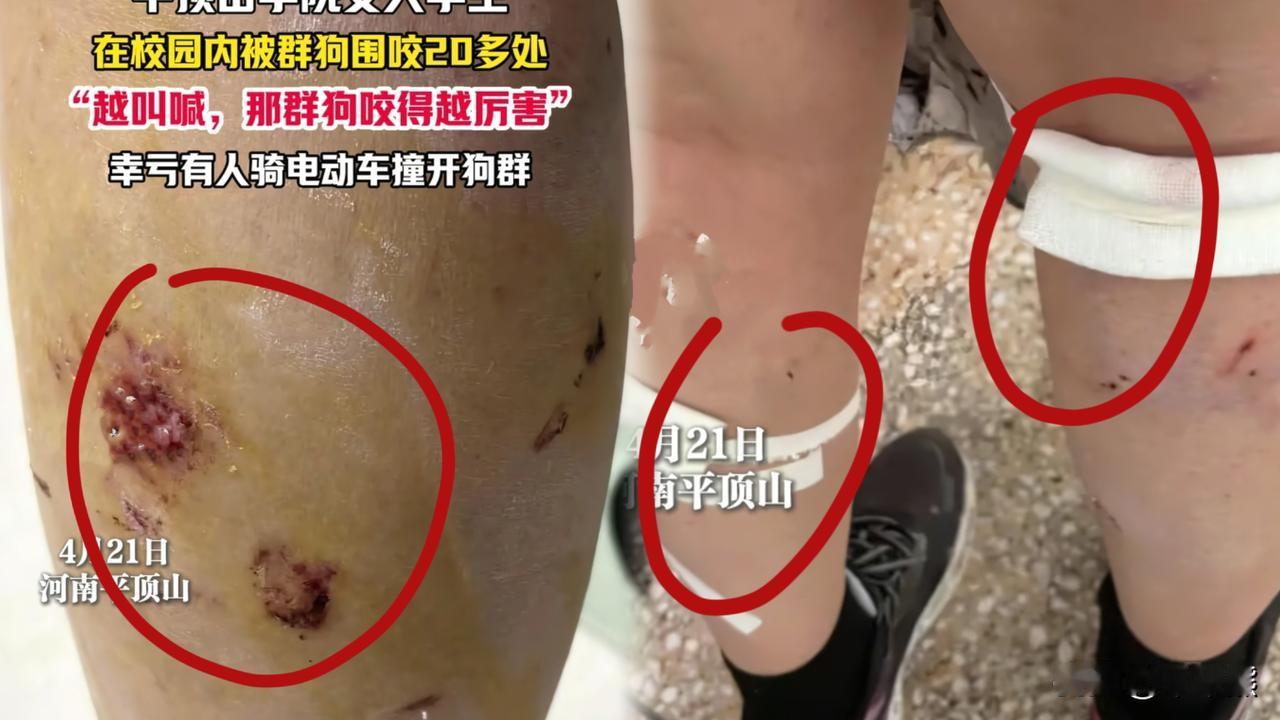 可怕的沉默：“爱狗人士”集体失声，这叫反噬！

两年前平顶山学院那个因为清理流浪