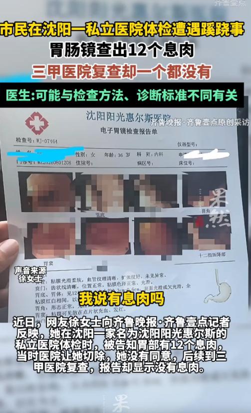 丧尽天良！辽宁沈阳，女子陪丈夫参加单位体检，自己顺手也查了一下胃肠镜。麻醉还没完