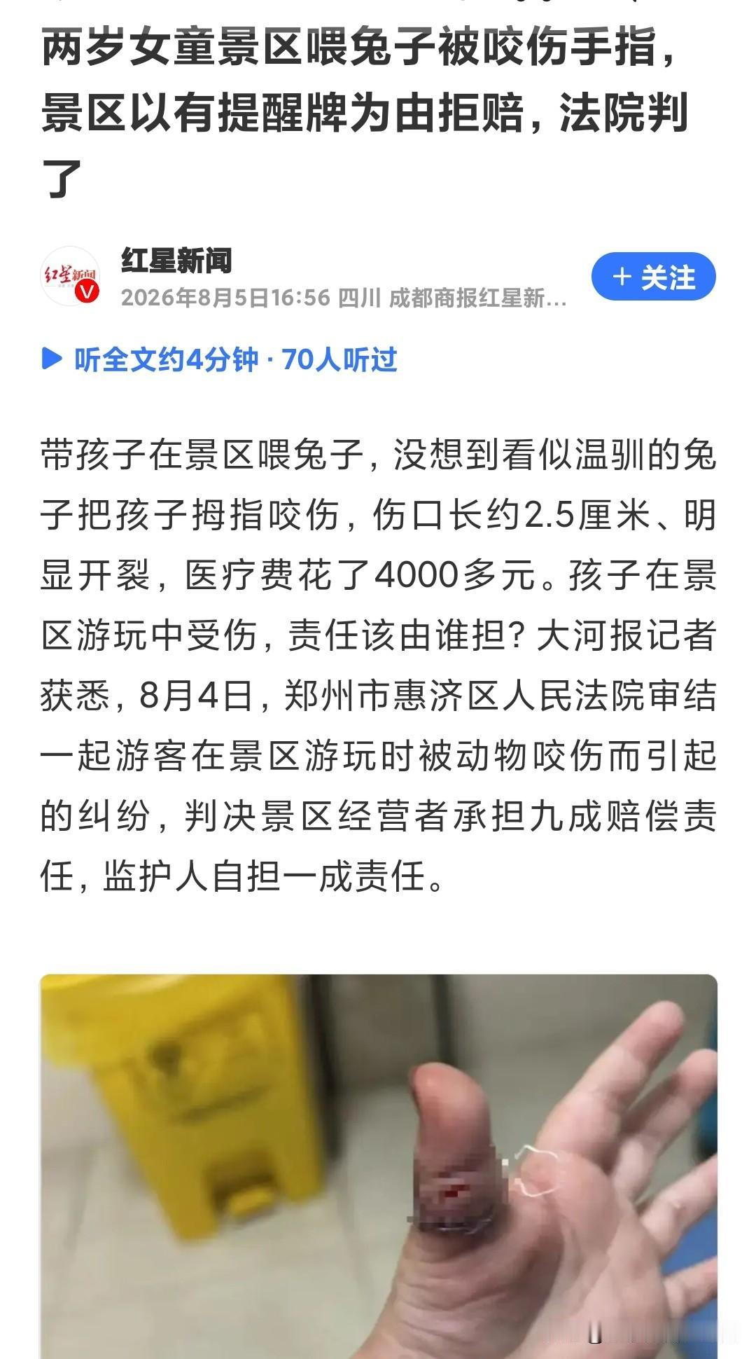 女童喂兔子手指被咬裂，景区：有提示不赔钱！法院最终这样判……
俗话说“兔子急了也