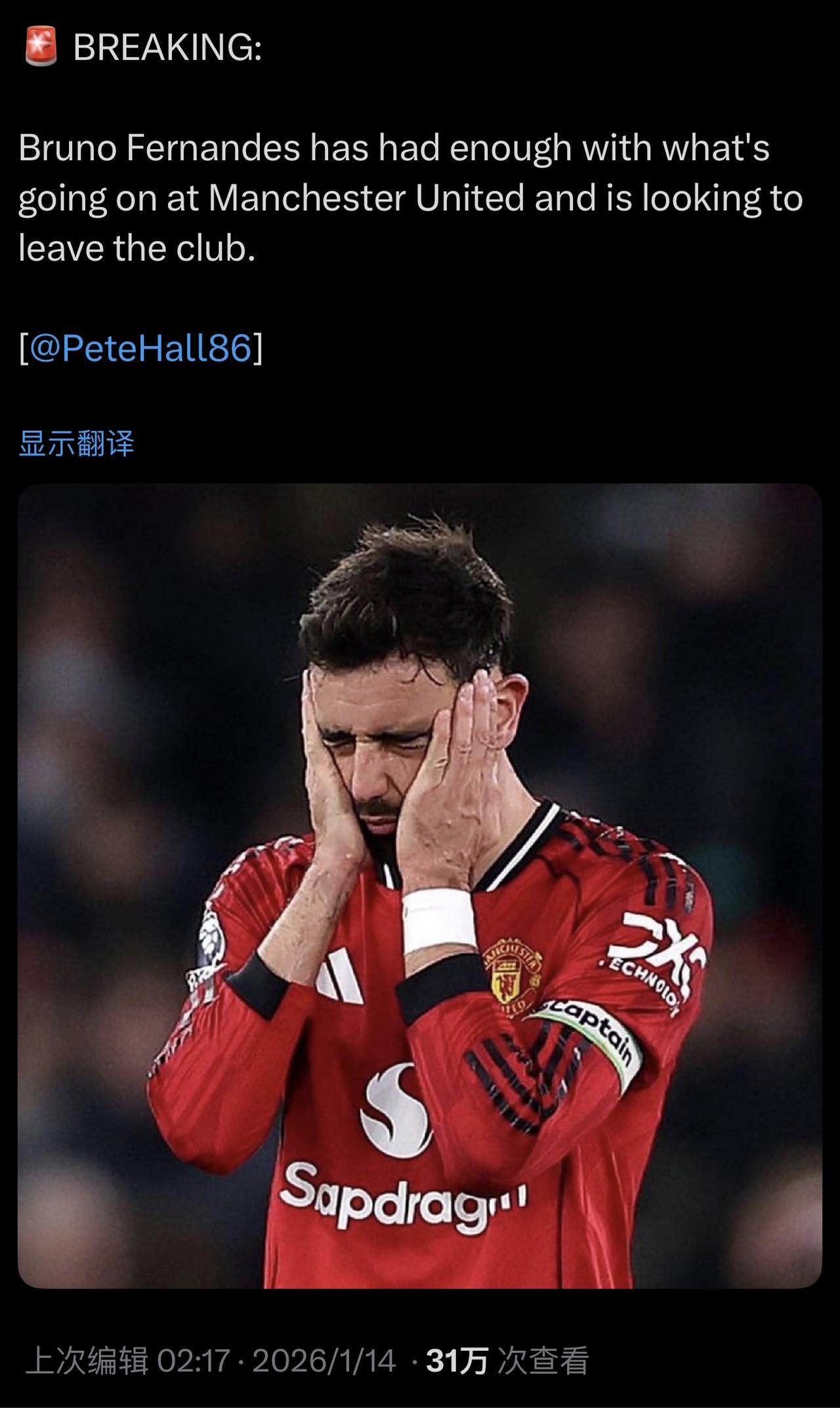 留到夏天再卖，现在不能卖！
如果阿莫林还是主教练，我把脚都举起来送B费走。
但现