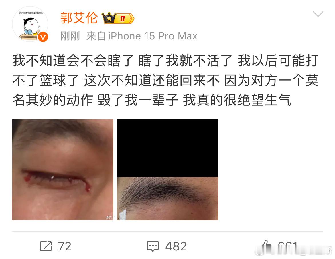 训练误伤这么严重 有点惨 