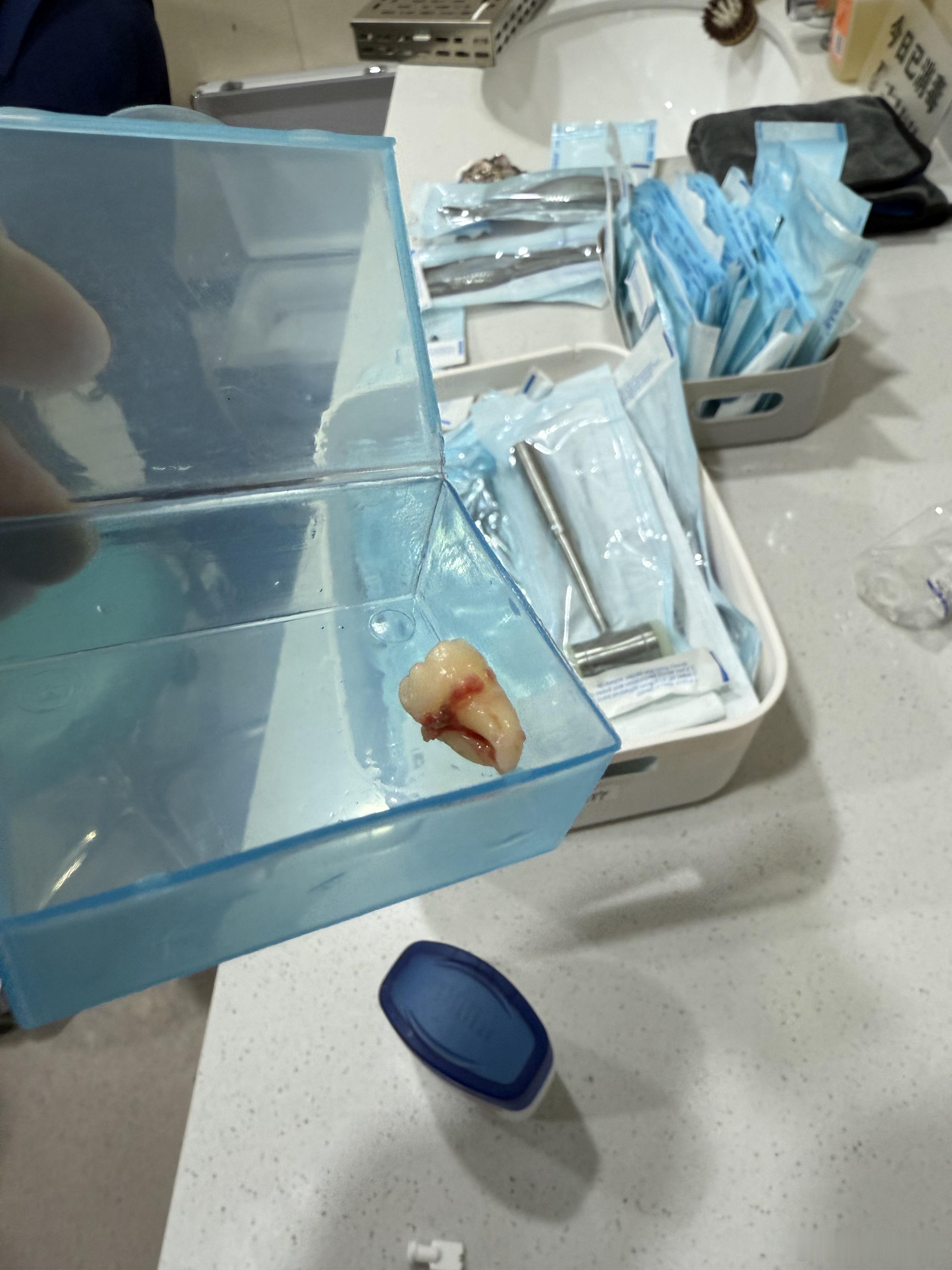 麻药过劲了[微笑]要疼晕过去 ​​​