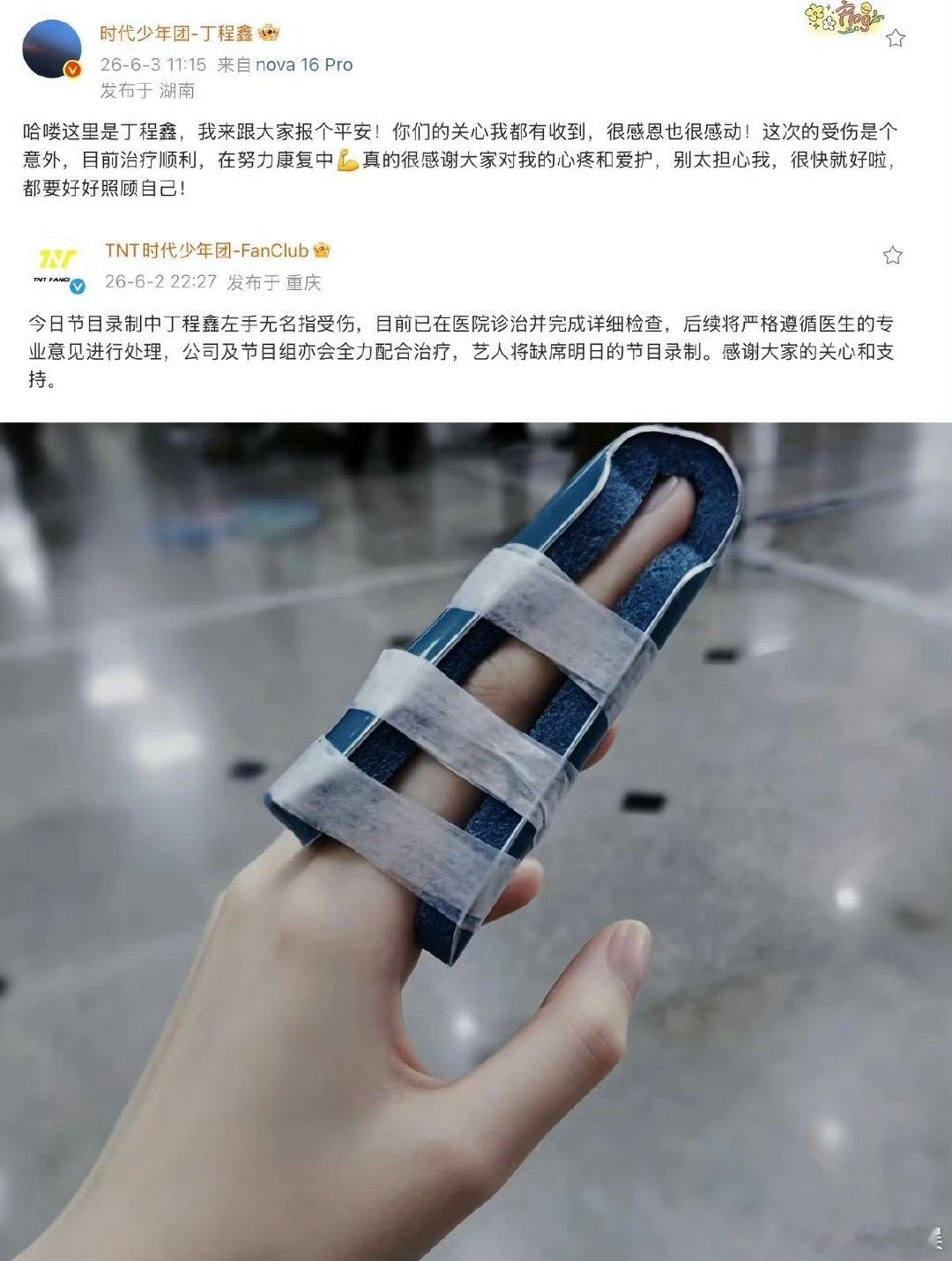 丁程鑫手第三次受伤了丁程鑫左手刚好右手又受伤丁程鑫的手已经不是第一次受伤了 
