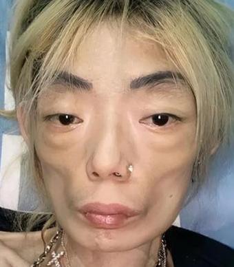2000年，模特伍智恒嫁永安百货太子爷郭永淳，8年婚姻，伍智恒做了10次肠胃手术