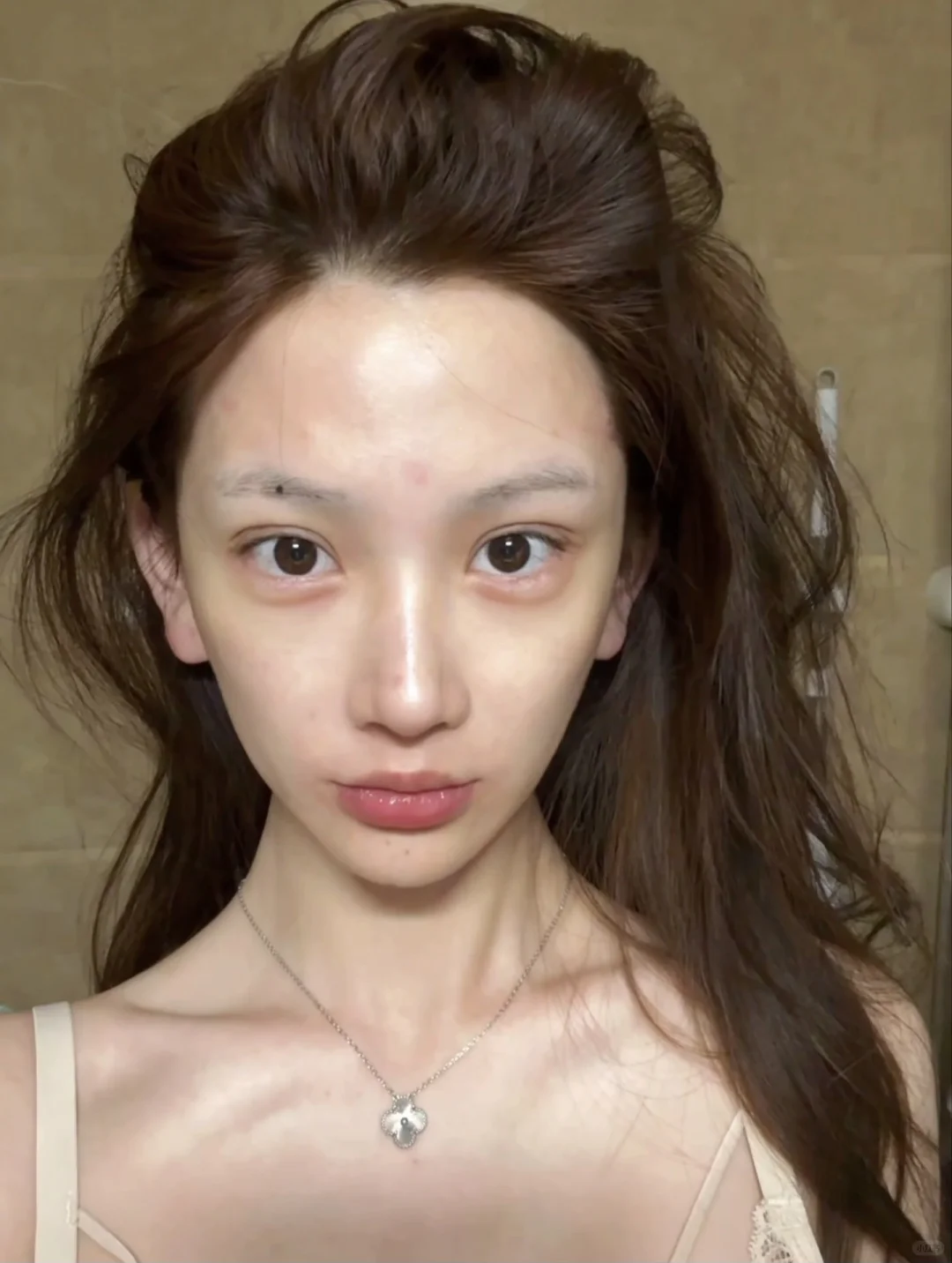 水土不服疯狂长痘