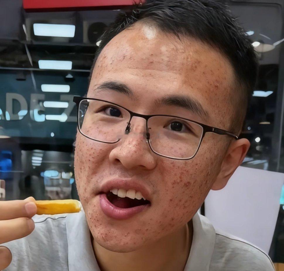 汉堡薯条吃多了，脸上痘痘都吃满，一过上美好生活哈哈哈哈哈哈哈哈 